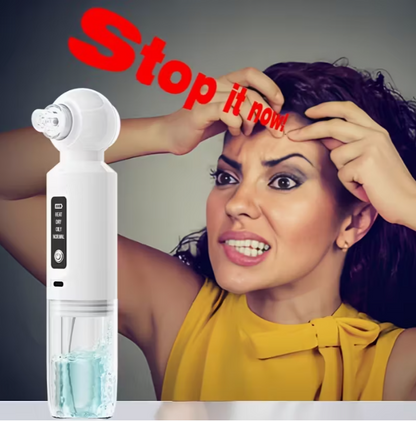 6-head blackhead cleaner, vacuum electric blackhead pore cleaner, USB charging mini bubble beauty device,To activate heating mode, press and hold the power button for 3 seconds.Automatically maintains a constant temperature of 46°C.